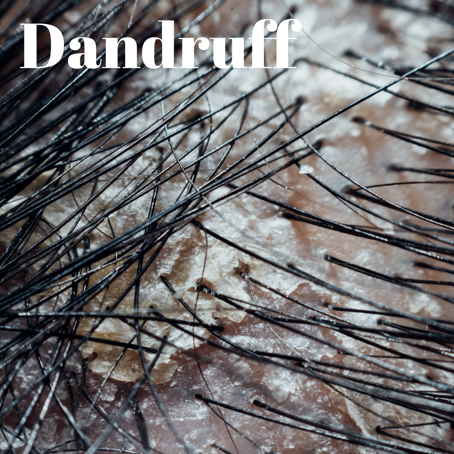 Tsunami Aloe Vera Shea Butter & Vitamin E Shampoo and Conditioner Bundle - Moisturizing & Nourishing for Curly, Dry Hair